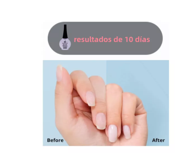 Tratamiento De Uñas Endurecdor Mecanico 15ml Cherimoya