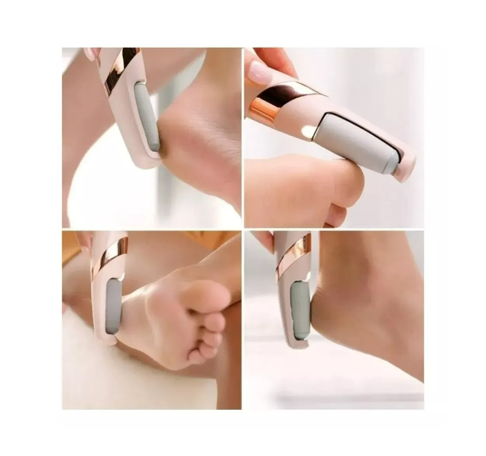 Removedor Callos Quita Callos Electrico Saca Callos Usb/ Led