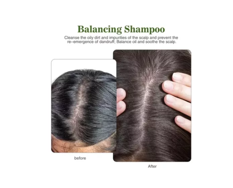 Shampoo Maxcare Anti-oil 400ml Para Cabello Graso